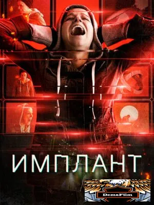 Имплант 2021