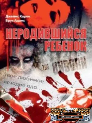 Неродившийся ребенок 1991