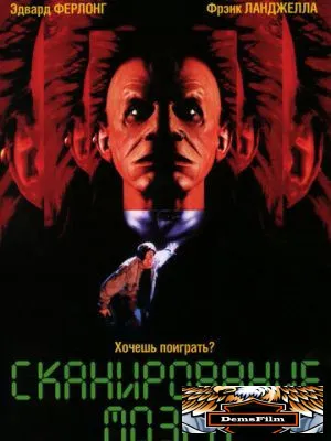 Сканирование мозга 1994